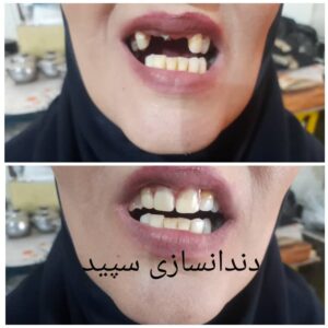 دندانسازی سپید لاهیجان (1)