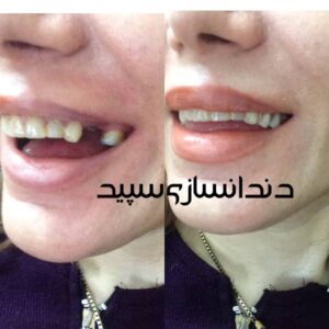 دندانسازی سپید لاهیجان (10)