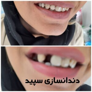 دندانسازی سپید لاهیجان (11)