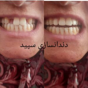 دندانسازی سپید لاهیجان (14)