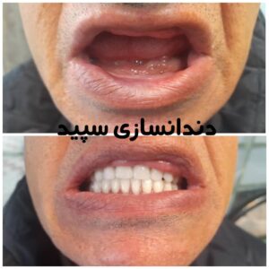 دندانسازی سپید لاهیجان (15)