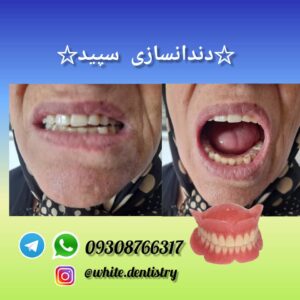 دندانسازی سپید لاهیجان (2)