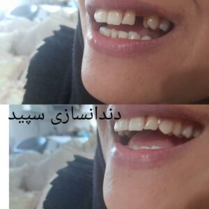 دندانسازی سپید لاهیجان (3)