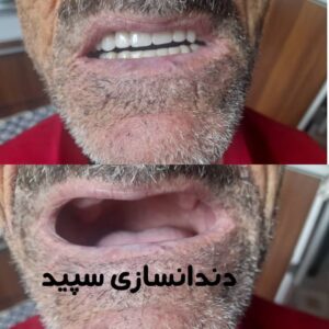 دندانسازی سپید لاهیجان (4)