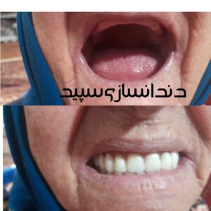 دندانسازی سپید لاهیجان (7)