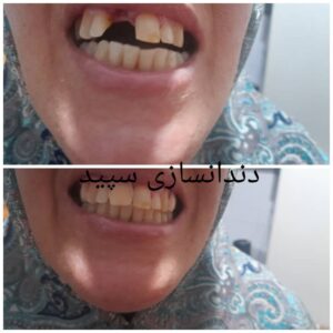 دندانسازی سپید لاهیجان (8)