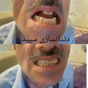 دندانسازی سپید لاهیجان (9)