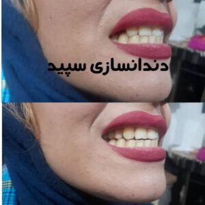 ff-f5a386e3f63a534b669f418674adbf24-ff-IMG-20230718-WA0010
