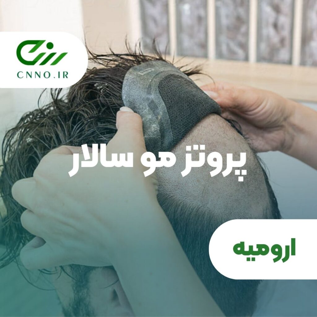 پروتز مو سالار در ارومیه - سینو